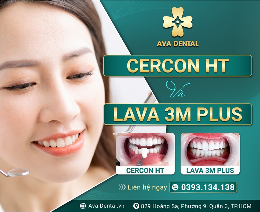 CERCON HT VA LAVA 3M PLUS 01